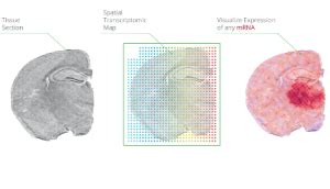 A Guide To Spatial Transcriptomics