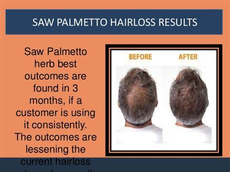 Saw Palmetto Miracle Results