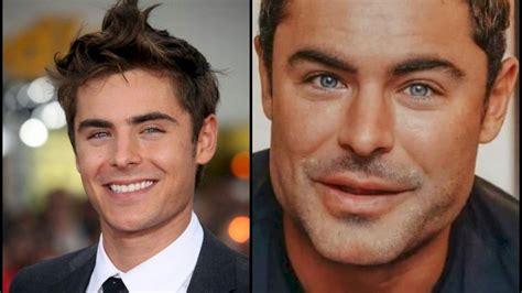 Zac Efron Habló Sobre Los Cambios En Su Rostro Red 92 Cada Día Más