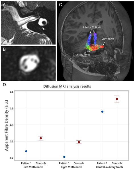 Jcm Free Full Text Diffusion Weighted Magnetic Resonance Imaging