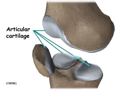 Meniscal Injuries EOrthopod