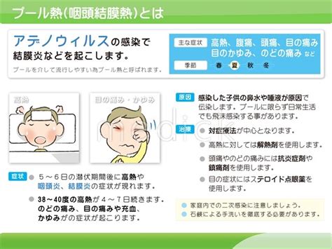 プール熱（咽頭結膜熱）とはの説明スライド 医療のイラスト・写真・動画、素材販売サイトのメディックmedick