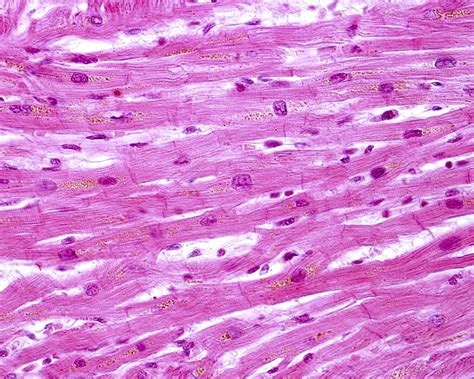 Ideias De Tecido Muscular Tecido Muscular Muscular Histologia