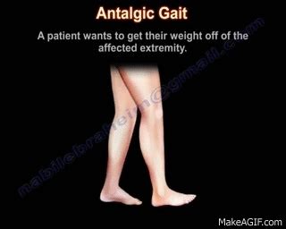 Antalgic Gait - Everything You Need To Know - Dr. Nabil Ebraheim on Make a GIF