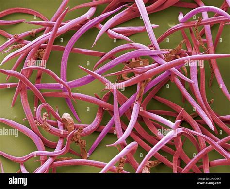 Nematodes Coloured Scanning Electron Micrograph Sem Of