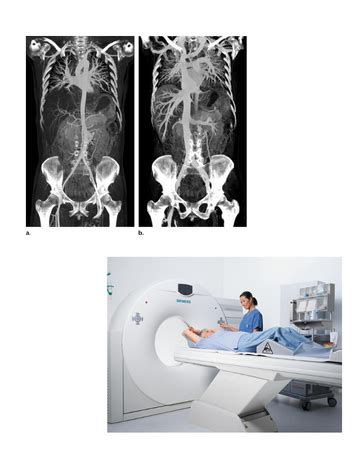 CT scan for Abdomen angio | Cost @ Rs. 4999/- | Medintu