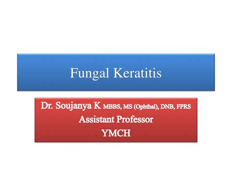 Ppt Fungal Keratitis Powerpoint Presentation Free Download Id8876972