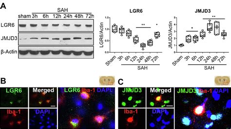 Maresin Activates Lgr To Alleviate Neuroinflammation Via The Creb