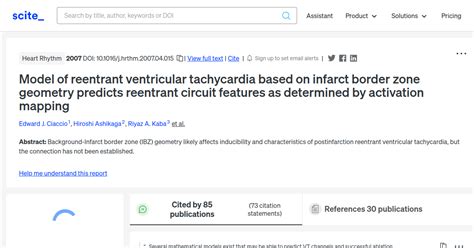 Model Of Reentrant Ventricular Tachycardia Based On Infarct Border Zone