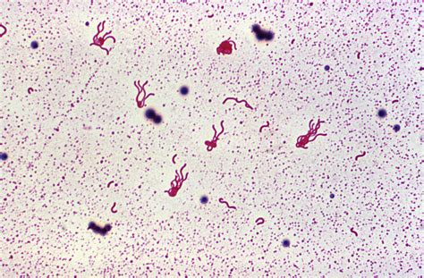 Flagella Stain