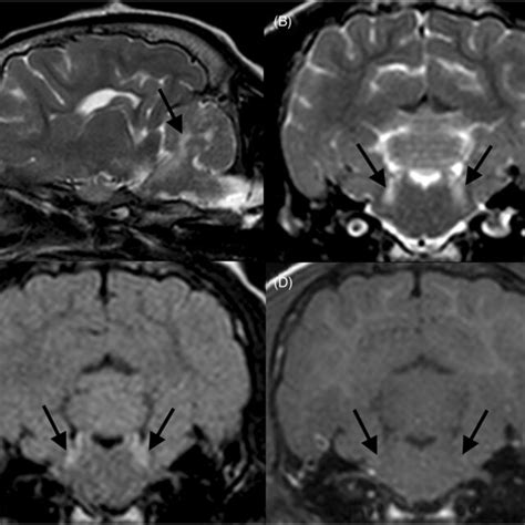 A T W Parasagittal Image B T W Transverse Image At The Level Of