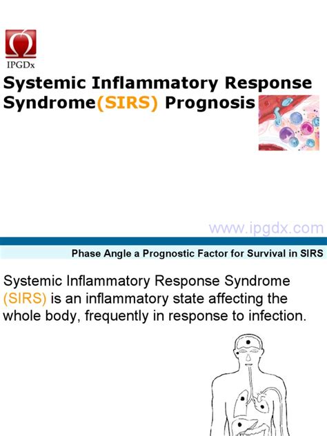 Systemic Inflammatory Response Syndrome Sirs Prognosis Download Free Pdf Sepsis Medical