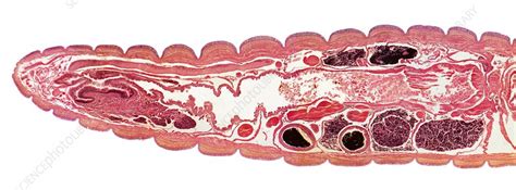 Earthworm Ganglia