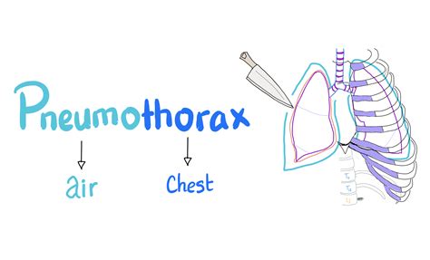 Pulmonology Illustrated Notes (PDFs) — Medicosis Perfectionalis