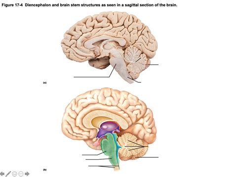 Midbrain & Hindbrain Diagram | Quizlet