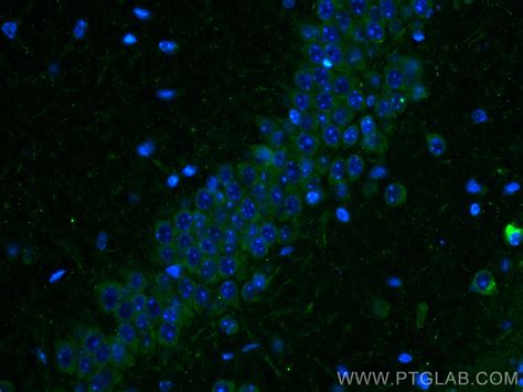 Somatostatin Aa Antibody Ap Proteintech