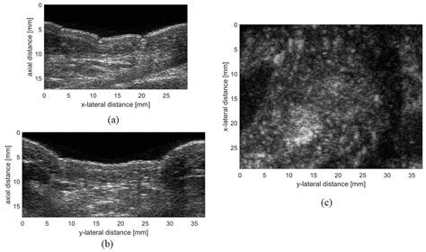 Sensors Free Full Text Ultrasound Systems For Biometric Recognition