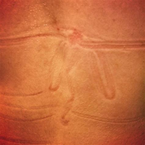 Its Summer Time Bikini Skin Girl Sunburn Summer Time Bikinis