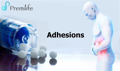 Adhesions | Premilife - Homeopathic Remedies