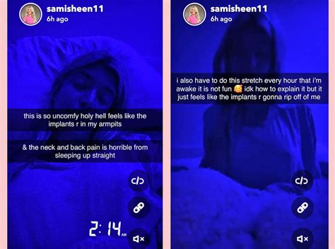 Sami Sheen Got The Boob Job And She S Sharing The Entire Journey On
