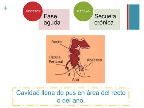 Abscesos Fistulas Anorectales Enfermedad Pilonidal Ppt