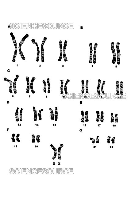 Photograph | Normal Female Karyotype | Science Source Images