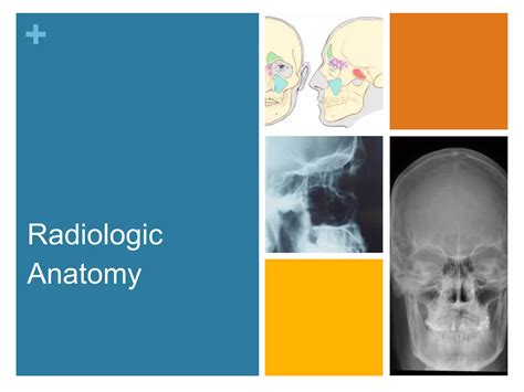 Nasal Cavity And Paranasal Sinuses Radiologic Anatomy Ppt