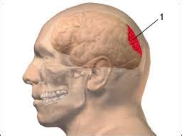 Intracranial hematoma