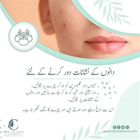 𝐓𝐡𝐞 𝐂𝐥𝐢𝐧𝐢𝐜 𝐋𝐚𝐡𝐨𝐫𝐞 on Instagram بیوٹی ٹپ thecliniclahore