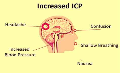 Cerebral Edema Brain Swelling Types Symptoms Causes And Treatment