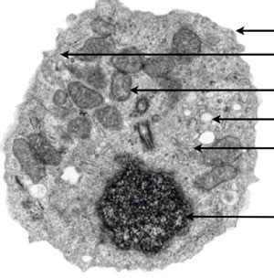 Electron Micrograph Of Eukaryotic Cell Diagram Quizlet