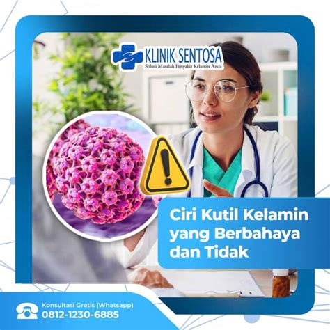 Ciri Ciri Kutil Kelamin Yang Berbahaya Dan Tidak Klinik Utama Sentosa