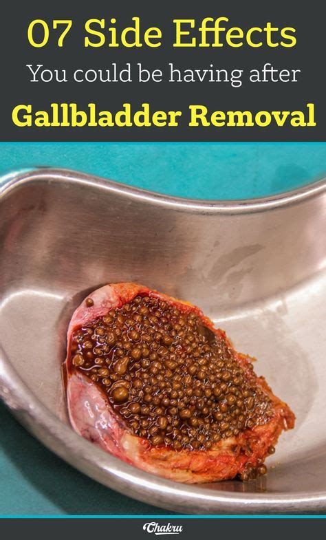 8 Best #gallbladder diet after surgery images in 2020 | Food and drink ...