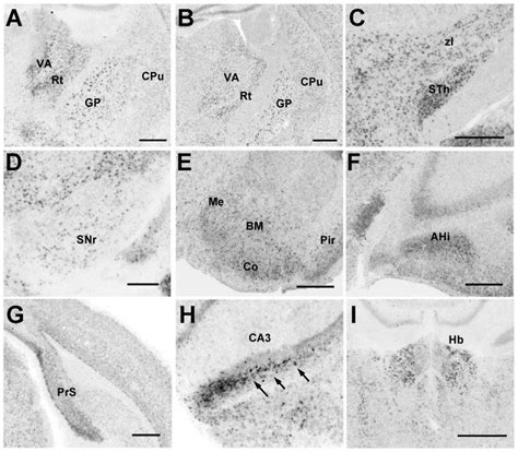 Caudate Putamen Cpu At P14 A And The Adult Stage B Sth C Snr Download Scientific