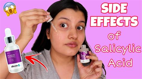 SIDE EFFECTS Of Salicylic Acid Is Salicylic Acid Safe To Use For ACNE