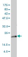 Anti Kras Antibody Mouse Anti Human Monoclonal If Wb Lsbio