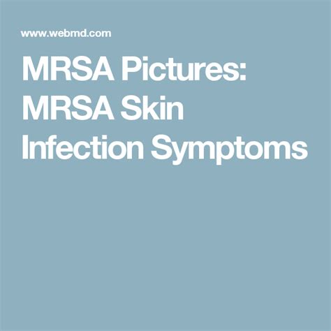 Mrsa What You Need To Know About This Mrsa Skin Infection Staph Infection