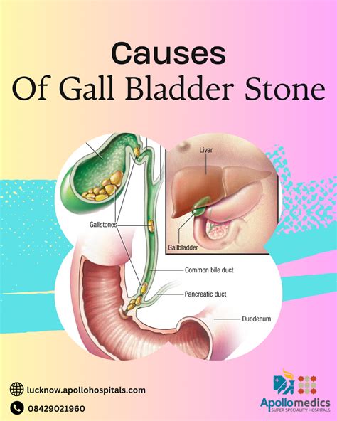 Female Gall Bladder Symptoms What You Need To Know By Apollomedics