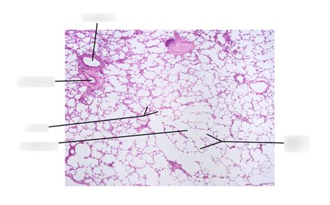 Lung Histology Diagram