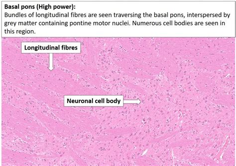 Brain Pons Nus Pathweb Nus Pathweb