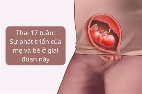 Triệu chứng và nguyên nhân bụng bầu 17 tuần