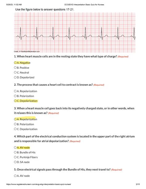 Ecg Ekg Interpretation Basic Quiz For Nurses 1 When Heart Muscle Cells Are In The Resting