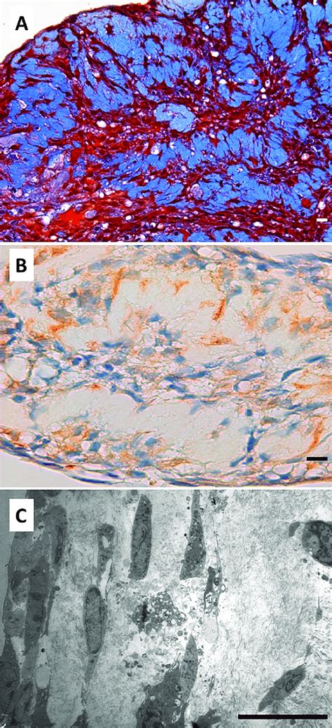 Cellular Morphology And Extracellular Matrix Characteristics Of HDPSCs