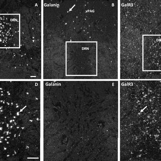 Dark Field ISH Photomicrographs Showing The Distribution Of NNOS A