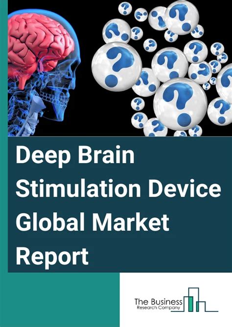 Sacral Nerve Stimulation Devices Market Report 2024 Sacral Nerve