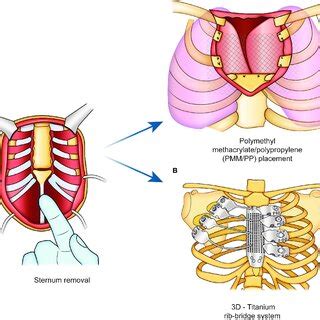 Radial forearm free flap (Morita et al., 2018) | Download Scientific ...