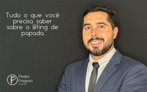 Tudo O Que Voc Precisa Saber Sobre O Lifting De Papada Dr Pedro Fragoso