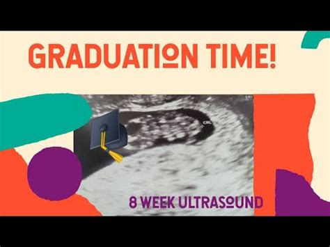 Ivf Episode Week Ultrasound Graduation To Ob Care Youtube