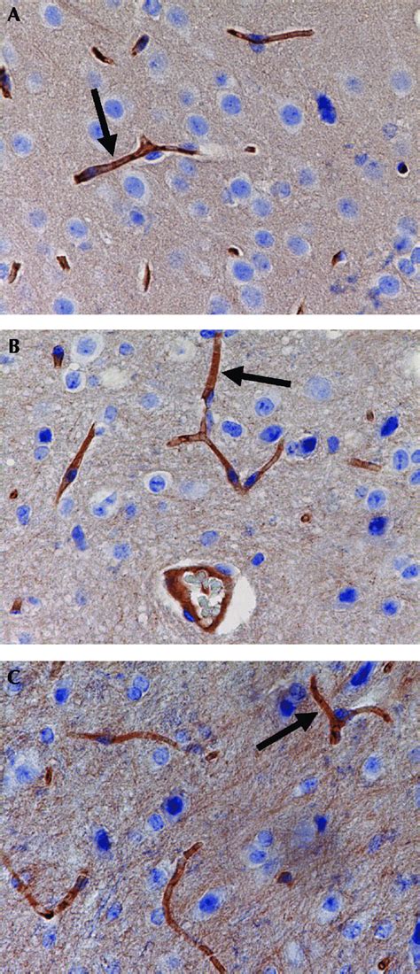 Immunohistochemical staining of brain sections by using C219 monoclonal ... 