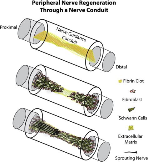 Advances In Bioengineered Conduits For Peripheral Nerve Regeneration